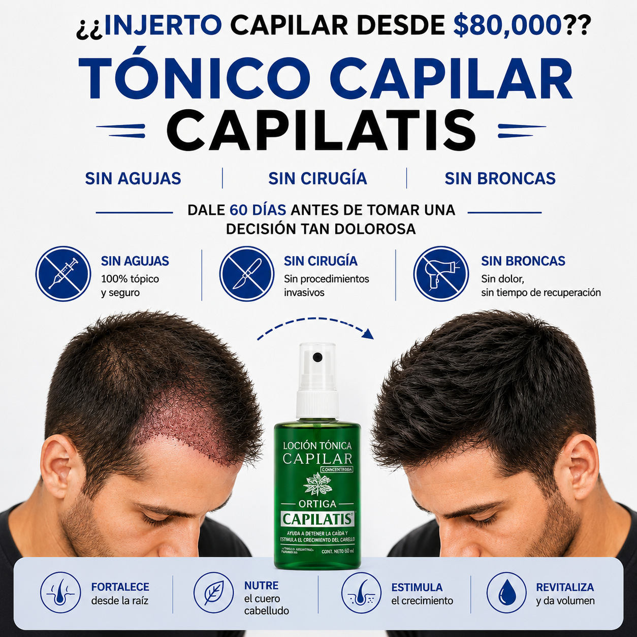 Tónico capilar Capilatis