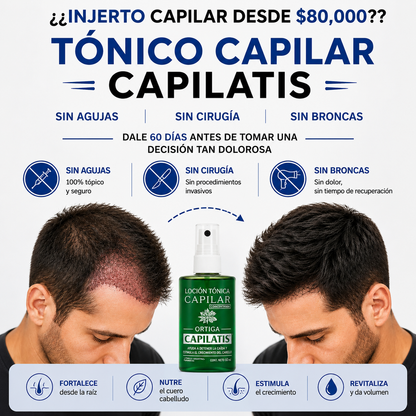 Tónico capilar Capilatis